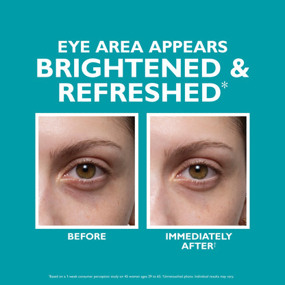 Peptide Skinjection™ Fill + Fix Under-Eye Cream